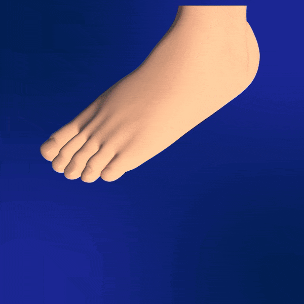 Plantar Fasciitis Treatment